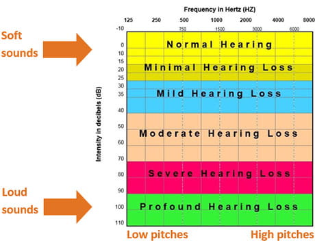 Chart for hearing loss evaluation.